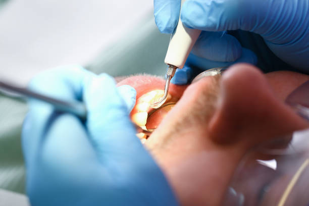 Best Tooth Infection Emergency Dentist  in White House, TN