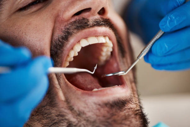 Best Broken Tooth Emergency  in White House, TN